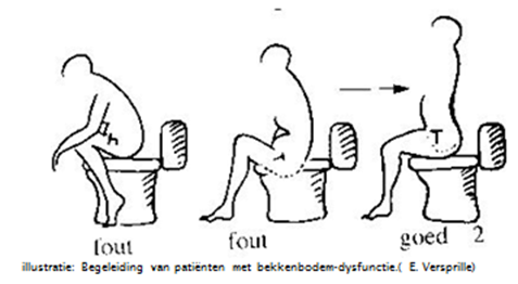 illustratie van foute en goede zithouding bij het plassen