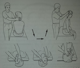instructies voor de Epley manoeuvre