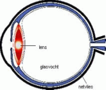 oog waarbij de ruimte tussen lens en netvlies gevuld met glasvocht