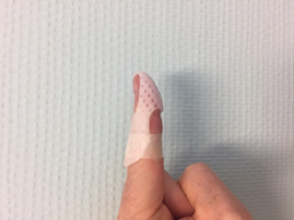 foto van vinger met een korte malletspalk
