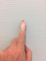 tape ter ondersteuning van de malletspalk