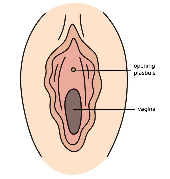 vagina en plasbuis